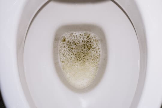 Comment éliminer l'odeur d'urine dans les toilettes ? Astuces et bonnes pratiques